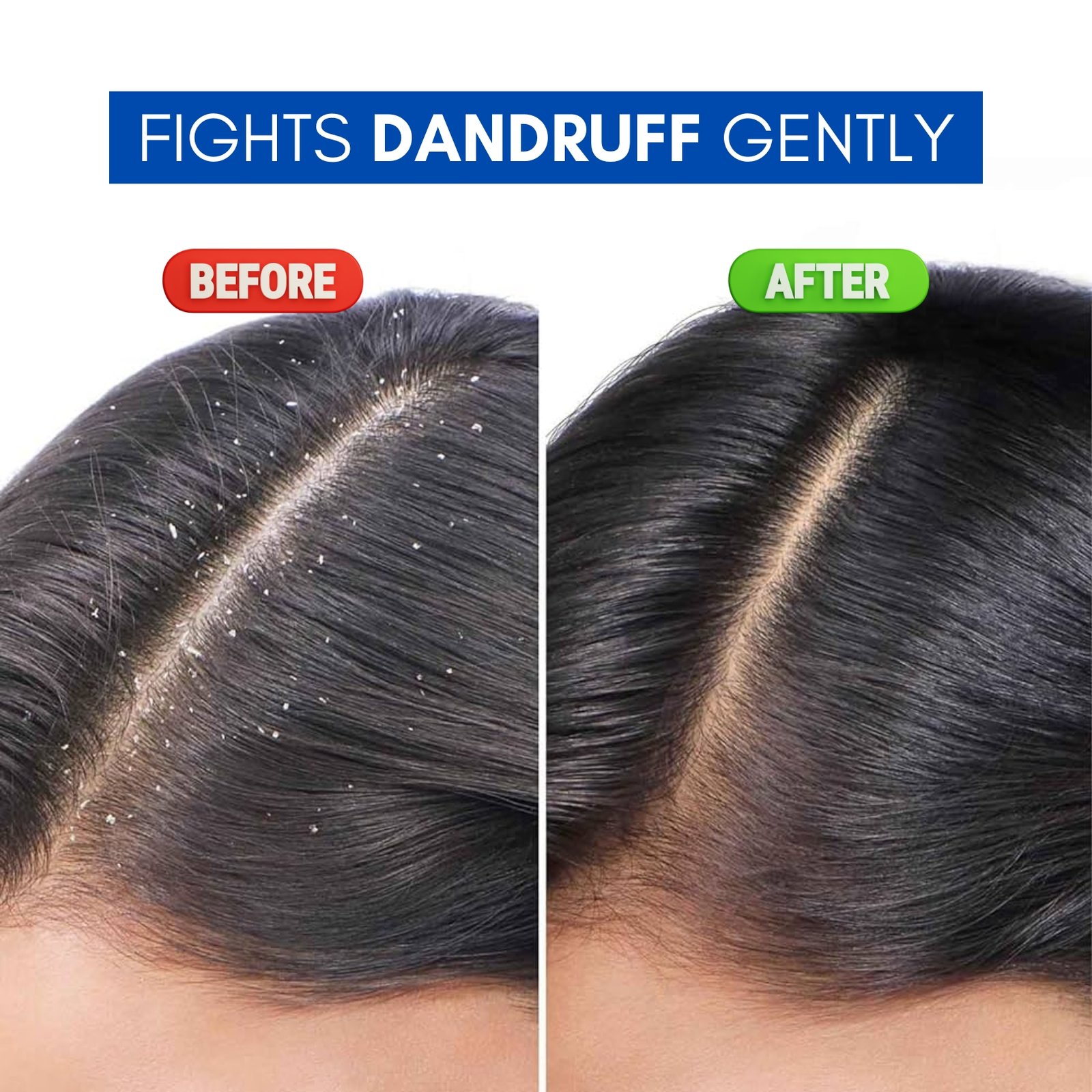 Sporotral-KZ-Shampoo